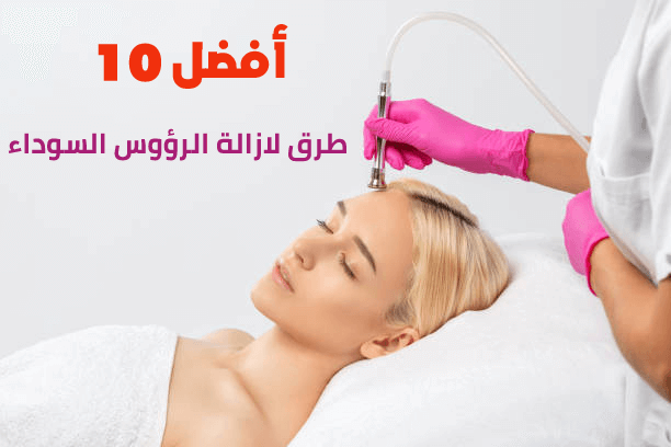 أفضل 10 طرق لإزالة الرؤوس السوداء